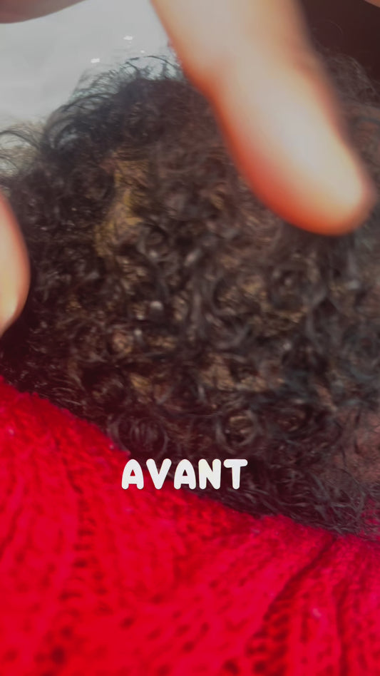 Doudou Balm - Anti-cradle cap - Can be used from 1 month